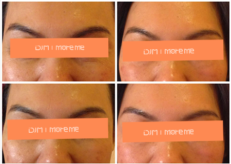 1.png