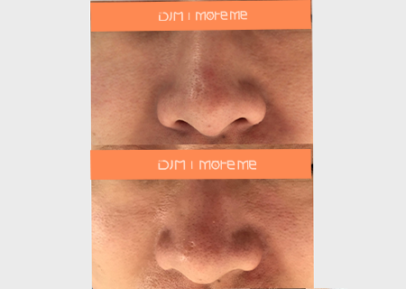 1.png 1.png