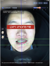 5.1.png